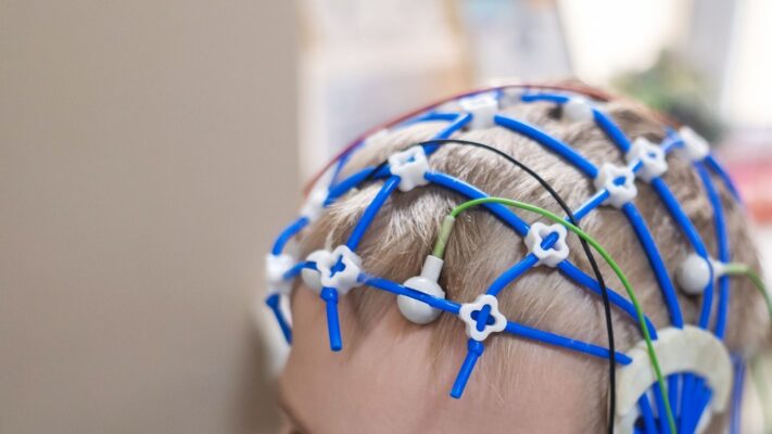 Cocuklarda Epilepsi Belirtileri Tani ve Tedavi Yontemleri