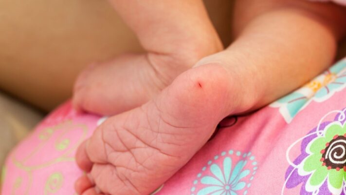 Topuk Kani Nedir Bebekten Topuk Kani Neden Alinir