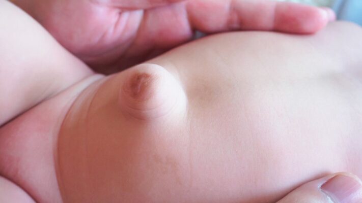 Bebeklerde Kasik Fitigi Nedir Belirtileri Nelerdir